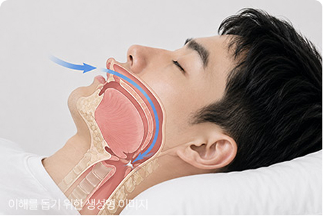 숨이 턱 막히며 깨는 느낌