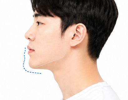 턱 위치 후