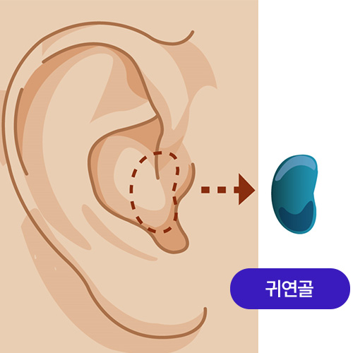 귀연골