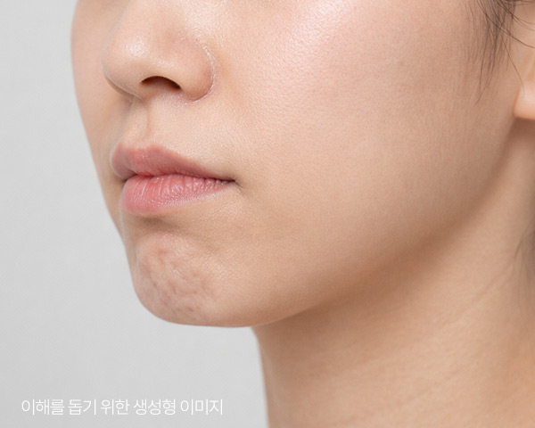 입 다물 때 턱 끝에 힘이 들어가는 모습