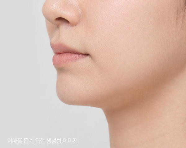 필러 후에도 답답함이 유지되는 모습