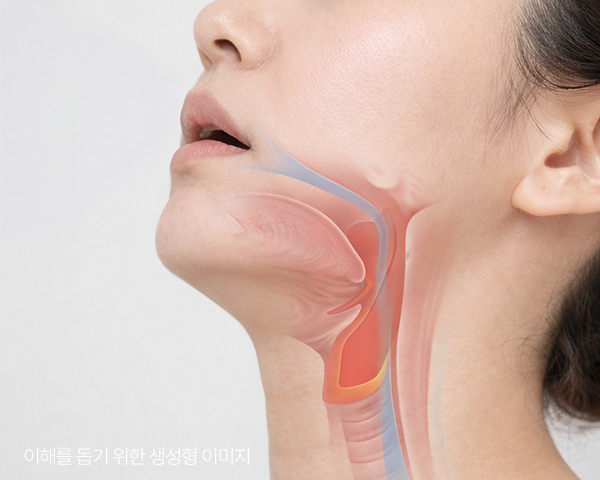 이중턱이 있던 사례