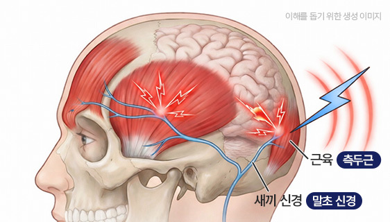 말초 신경과 근육의 관계 설명 이미지