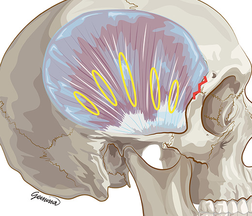 일상생활 바로 가능