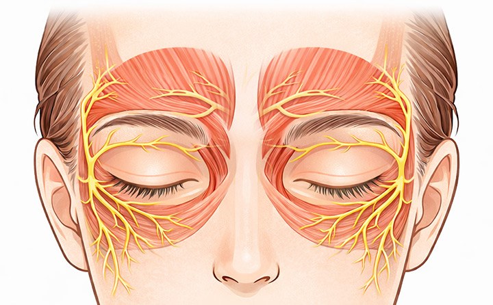 MRI / CT 검사 통해